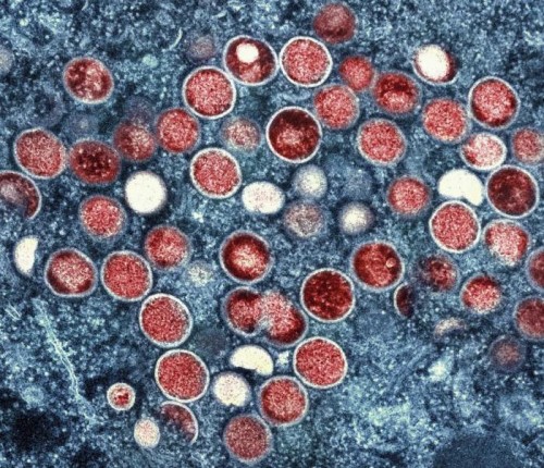 世衛組織宣佈猴痘疫情不再構成「國際關注的突發公共衛生事件」